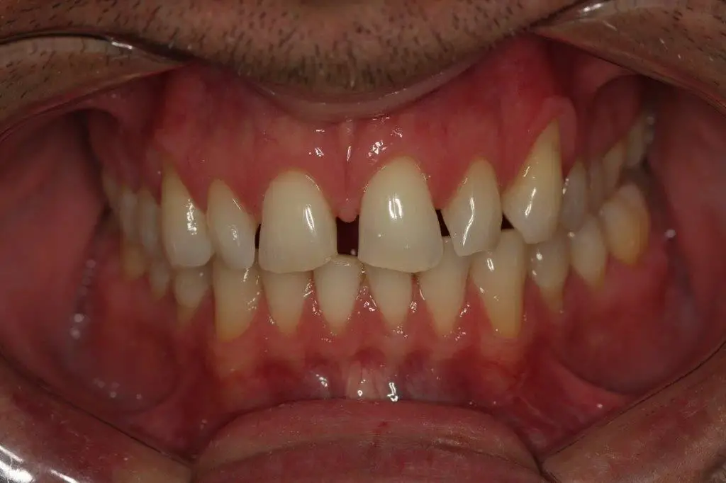 IMG_1755 MR IMG_1755 MR