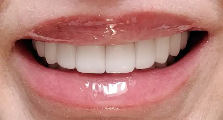 Toronto-cosmetic-dentistry