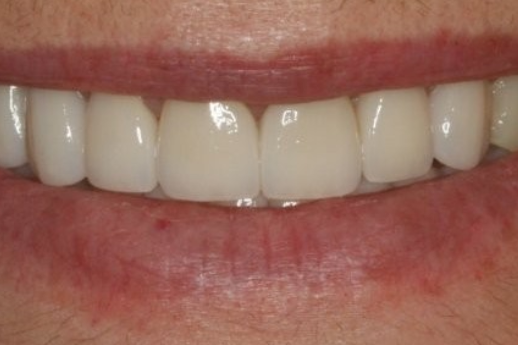 img2547 after